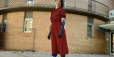 Rut Carpintero Mediavilla vivir con cuatro prótesis en las cuatro extremidades